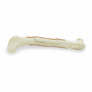 FEMUR ESPONJOSO COM FRATURAS MULTIPLAS ESQUERDO - CÃO GRANDE - cód. AV250 ESPF4