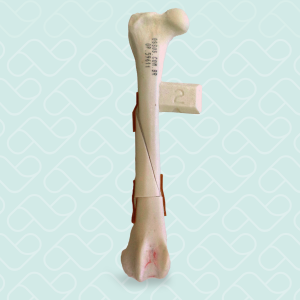 FEMUR COM FRATURA BORBOLETA - DIREITA - CÃO GRANDE - cód. 10493