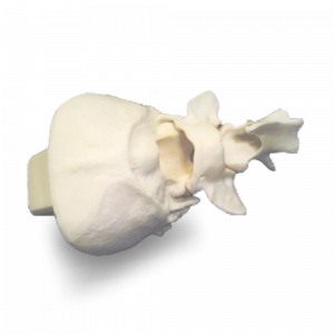 OCCIPITAL COM C1 E C2 - CÃO P - cód. AV116 P