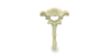 T1