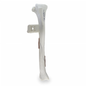 TIBIA ESPONJOSA COM BLOCO E FRATURA OBLIQUA - DIREITA - CÃO GRANDE - cód. 10492
