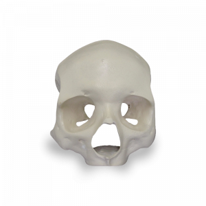 CRÂNIO FRONTAL All-on-4® HIBRIDO - cód. 9013