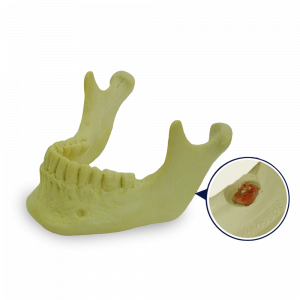 MANDIBULA COM TODOS OS DENTES E 3º MOLAR INCLUSO - cód. 4402 - 02