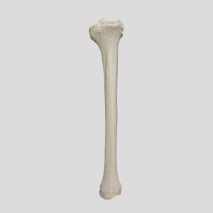 TIBIA RADIOPACA DIREITA INFANTO JUVENIL - cód. 12374