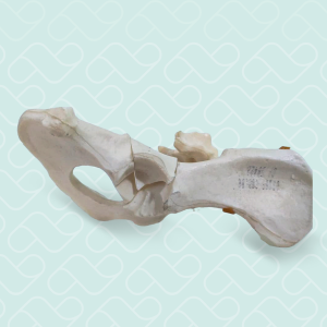 PELVIS DIREITA COM FRATURA ACETABULAR E LUXAÇÃO SACROILIACA - CÃO GRANDE - cód. 10517