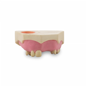 MAXILA COM ALGUNS DENTES E DUPLA GENGIVA - cód. 11082
