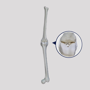 JOELHO DIREITO RADIOPACO  E SIMULAÇAO DE LIGAMENTOS - cód. 12378