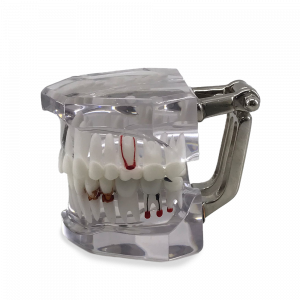MANEQUIM COM ENDODONTIA E IMPLANTES - cód. 13854