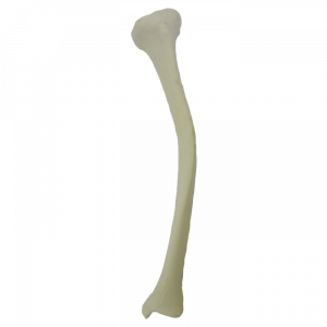 TÍBIA ESQUERDA COM DEFORMIDADE MEDIAL VARO - cód. 2026 DMVR