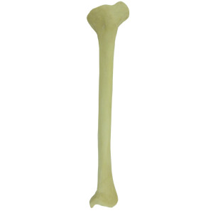TÍBIA  RADIOPACA ESQUERDA COM DEFORMIDADE PROXIMAL VARO ROTAÇÃO INTERNA - cód. 12450