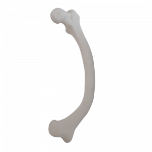 FEMUR ESQUERDO DE RAQUITISMO VARO DUPLO - cód. 2025 RVD