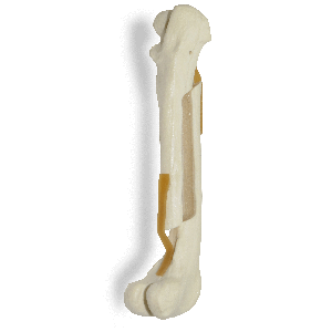 FÊMUR DIREITO COM CANAL MEDULAR E ESPONJOSO COM FRATURA MEDIAL - CÃO GRANDE - cód. AV200 ESPF1