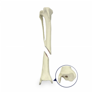 TÍBIA DIREITA COM CANAL MEDULAR E ESPONJOSO COM FRATURA DISTAL - CÃO GRANDE - cód. AV210 ESPF2