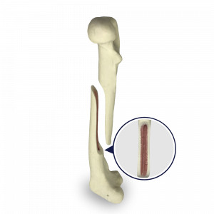 FÊMUR ESQUERDO COM CANAL MEDULAR E ESPONJOSO COM FRATURA MEDIAL OBLÍQUA LONGA - CÃO GRANDE - cód. AV250ESPF1