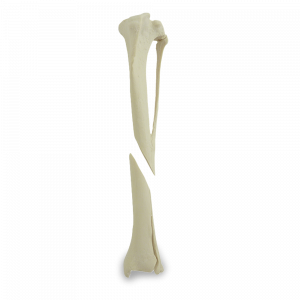 TÍBIA ESQUERDA COM FRATURA DISTAL - CÃO GRANDE - cód. AV260 ESPF2