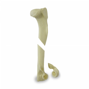 ÚMERO DIREITO COM CANAL MEDULAR E ESPONJOSO COM FRATURAS MÚLTIPLAS - CÃO GRANDE - cód. AV300ESPF2