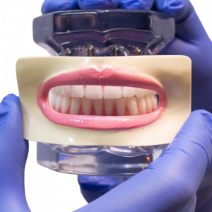 SORRISO 2 - cód. 4501